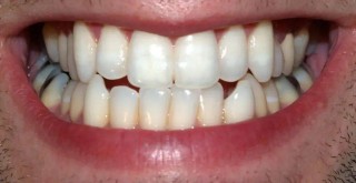 2024澳门资料大全2024免费新版_ 如果您的牙齿缺失，可以通过药物重新长出来。 这项新研究可能使许多人受益。